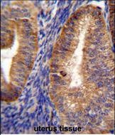 IHC-P - RUTBC1 Antibody (C-term) AP11573b