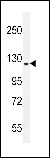 WB - RUTBC1 Antibody (C-term) AP11573b
