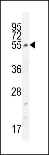 WB - CCDC61 Antibody (N-term) AP11587a
