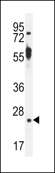 WB - TTC9B Antibody (C-term) AP11588b