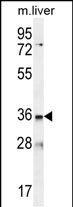 WB - LDLRAD3 Antibody (C-term) AP11592b
