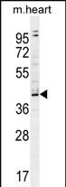 WB - ZBTB42 Antibody (N-term) AP11594a