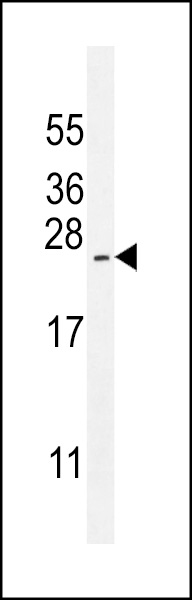 ARL17P1 Antibody (Center) (Cat. #AP11597c) western blot analysis in NCI-H460 cell line lysates (35ug/lane).This demonstrates the ARL17P1 antibody detected the ARL17P1 protein (arrow).
