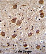 IHC-P - KCTD8 Antibody (C-term) AP11599b