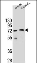 WB - KCTD8 Antibody (C-term) AP11599b