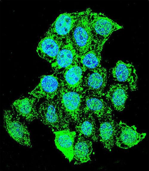 Confocal immunofluorescent analysis of ZMYND17 Antibody (C-term)(Cat#AP11600b) with Hela cell followed by Alexa Fluor 488-conjugated goat anti-rabbit lgG (green).DAPI was used to stain the cell nuclear (blue).