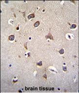 IHC-P - ZNF665 Antibody (N-term) AP11604a