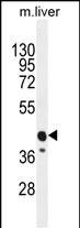WB - CACNG8 Antibody (N-term) AP11619A