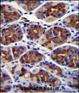 IHC-P - EPHX3 Antibody (C-term) AP11641b