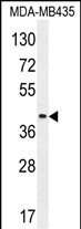 WB - LILRA5 Antibody (N-term) AP11643a