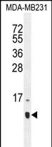 WB - HCFC1R1 Antibody (N-term) AP11644A