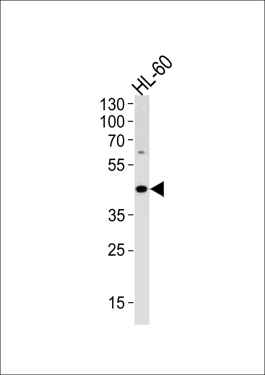 ADA Antibody (C-term) (Cat. #AP11650b) western blot analysis in HL-60 cell line lysates (35ug/lane).This demonstrates the ADA antibody detected the ADA protein (arrow).