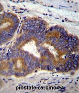 IHC-P - TUBB8B Antibody (C-term) AP11654b