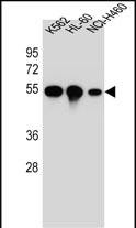 WB - TUBB8B Antibody (C-term) AP11654b
