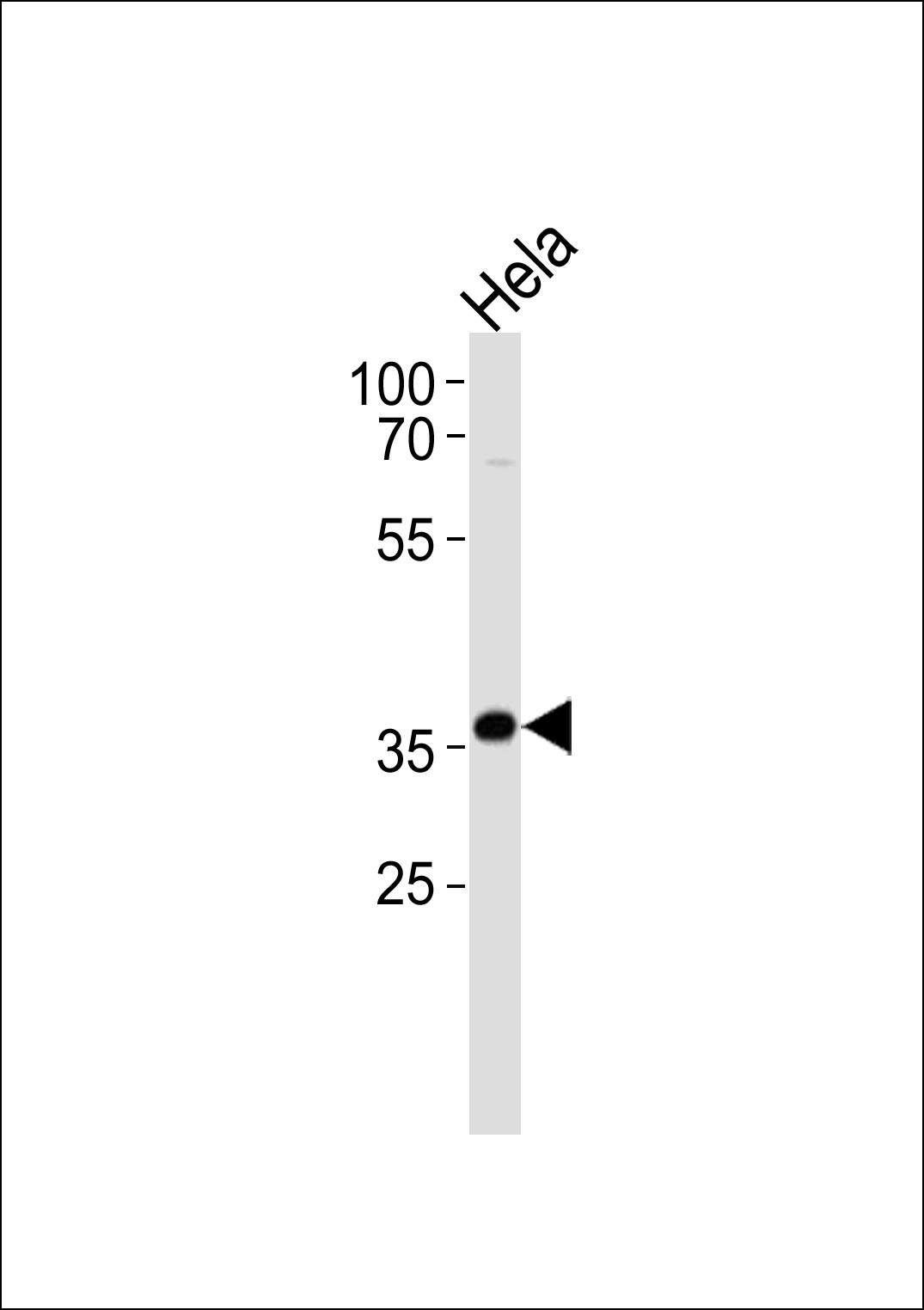 AKR1C3 Antibody (Center) (Cat. #AP11656c) western blot analysis in Hela cell line lysates (35ug/lane).This demonstrates the AKR1C3 antibody detected the AKR1C3 protein (arrow).
