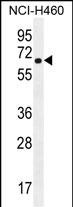 WB - CHRND Antibody (Center) AP11657c
