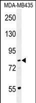 PCDHGA1 Antibody (Center) (Cat. #AP11662c) western blot analysis in MDA-MB435 cell line lysates (35ug/lane).This demonstrates the PCDHGA1 antibody detected the PCDHGA1 protein (arrow).