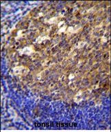 IHC-P - PTK9L Antibody (N-term) AP11665a