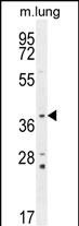 WB - PTK9L Antibody (N-term) AP11665a