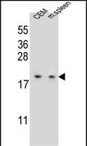 LSM7 Antibody (C-term) (Cat. #AP11679b) western blot analysis in CEM cell line and mouse spleen tissue lysates (35ug/lane).This demonstrates the LSM7 antibody detected the LSM7 protein (arrow).