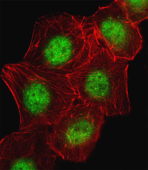 Fluorescent image of A549 cell stained with CREB1 Antibody (Center)(Cat#AP11707c).A549 cells were fixed with 4% PFA (20 min), permeabilized with Triton X-100 (0.1%, 10 min), then incubated with CREB1 primary antibody (1:25, 1 h at 37?). For secondary antibody, Alexa Fluor� 488 conjugated donkey anti-rabbit antibody (green) was used (1:400, 50 min at 37?).Cytoplasmic actin was counterstained with Alexa Fluor� 555 (red) conjugated Phalloidin (7units/ml, 1 h at 37?).CREB1 immunoreactivity is localized to Nucleus significantly.