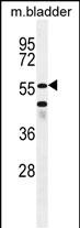 WB - SHQ1 Antibody (N-term) AP11715a