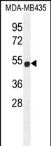 WB - ZNF286B Antibody (N-term) AP11723a