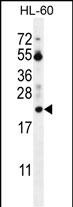 WB - PTMA Antibody (N-term) AP11770a