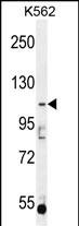 WB - AGBL5 Antibody (N-term) AP11785a