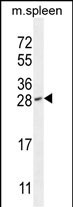 WB - IAH1 Antibody (Center) AP11792c