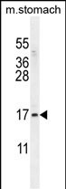 WB - ZNF428 Antibody (N-term) AP11794a