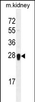 WB - ARL5C Antibody (N-term) AP11803a