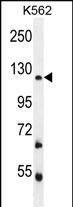 WB - FBRSL1 Antibody (C-term) AP11809b