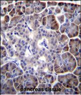 IHC-P - MYBPHL Antibody (N-term) AP11820A