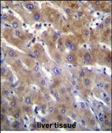 IHC-P - ANKRD18B Antibody (N-term) AP11824a