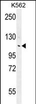WB - ANKRD18B Antibody (N-term) AP11824a