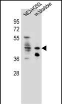 GHSR Antibody (C-term) (Cat. #AP11873b) western blot analysis in NCI-H292 cell line and mouse bladder tissue lysates (35ug/lane).This demonstrates the GHSR antibody detected the GHSR protein (arrow).