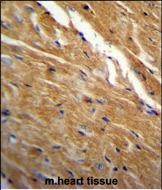 IHC-P - TBC1D13 Antibody (Center) AP11876c