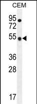 WB - TBC1D13 Antibody (Center) AP11876c