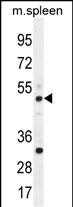 WB - TBC1D13 Antibody (Center) AP11876c