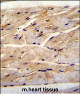 IHC-P - RMD1 Antibody  (N-term) AP11887a