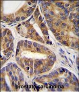 IHC-P - RNF215 Antibody (C-term) AP11895b