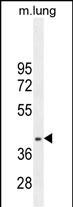WB - RNF215 Antibody (C-term) AP11895b