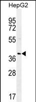 WB - RNF215 Antibody (C-term) AP11895b