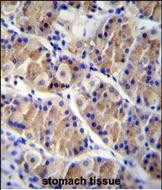 IHC-P - LRRC38 Antibody (C-term) AP11899b