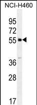 WB - SHISA6 Antibody (N-term) AP11913a
