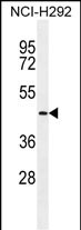 WB - TMPRSS11E2 Antibody (Center) AP11923c
