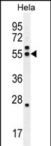 WB - TBB8B Antibody (C-term) AP11937b