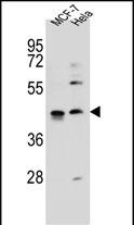 ZNF384 Antibody (C-term) (Cat. #AP11944b) western blot analysis in MCF-7,Hela cell line lysates (35ug/lane).This demonstrates the ZNF384 antibody detected the ZNF384 protein (arrow).