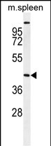 WB - STK32A Antibody (N-term) AP11949a